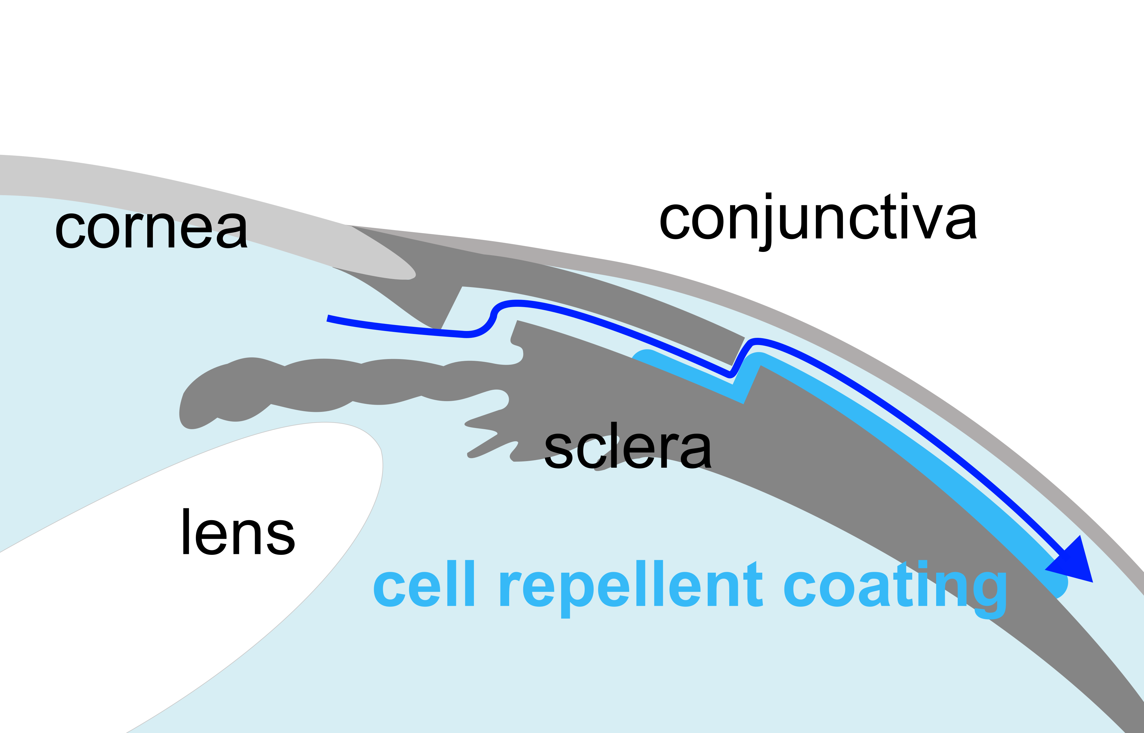 170209-schema-system-v2.png