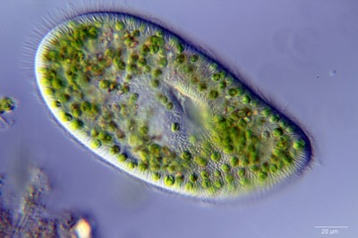 1620px-paramecium_bursaria.jpg