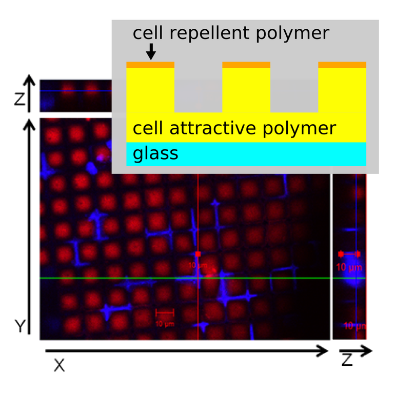 microscopic image of bone cancer cells on micropillar arrays: the nuclei are strongly deformed